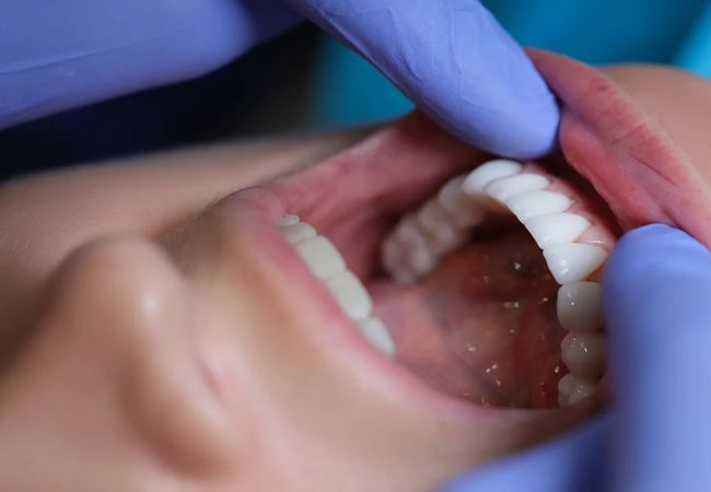 Odontologia Preventiva