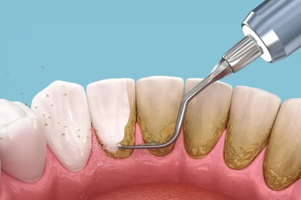 Periodontia