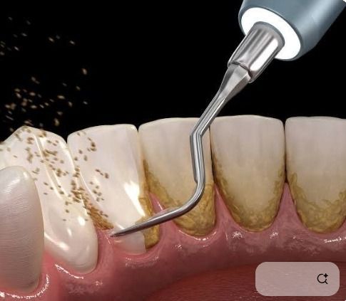 Cuidados Dirios com a Prtese Protocolo: Como Manter Seu Sorriso Sempre Saudvel | Edra Odontologia